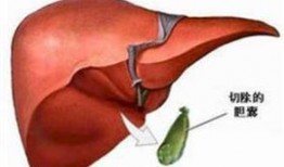 胆囊炎吃角瓜,天然食疗的养生之道